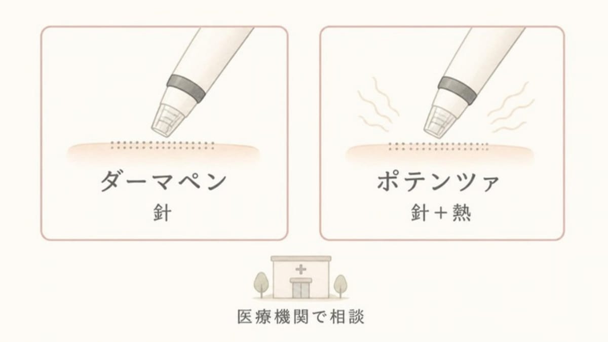 ダーマペン(針)とポテンツァ(針と熱)のちがいを並べ、どちらも医療機関で相談する施術であることを示した画像