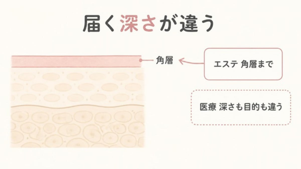 肌の断面図で、エステで届くのはいちばん外側の角層までで、医療とは深さも目的も違うことを示した画像