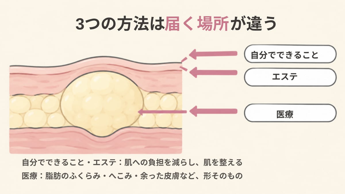 目の下の断面の図で、自分でできることとエステの矢印は肌の表面に、医療の矢印は脂肪のふくらみに向かい、3つの方法は届く場所が違うことを示した画像